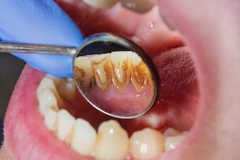 Periodontia